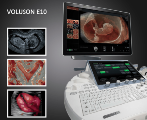 Promotional image of GE Voluson E10