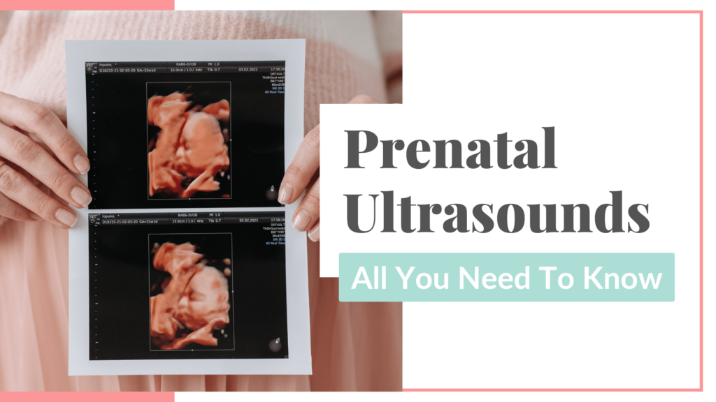prenatal ultrasounds