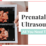 prenatal ultrasounds