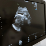 Sonography clinic melbourne