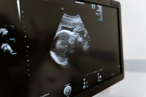 Sonography clinic melbourne